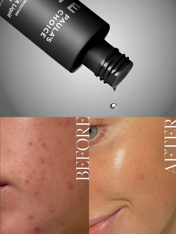 The Cult Exfoliator You Need In Your Skincare Routine
