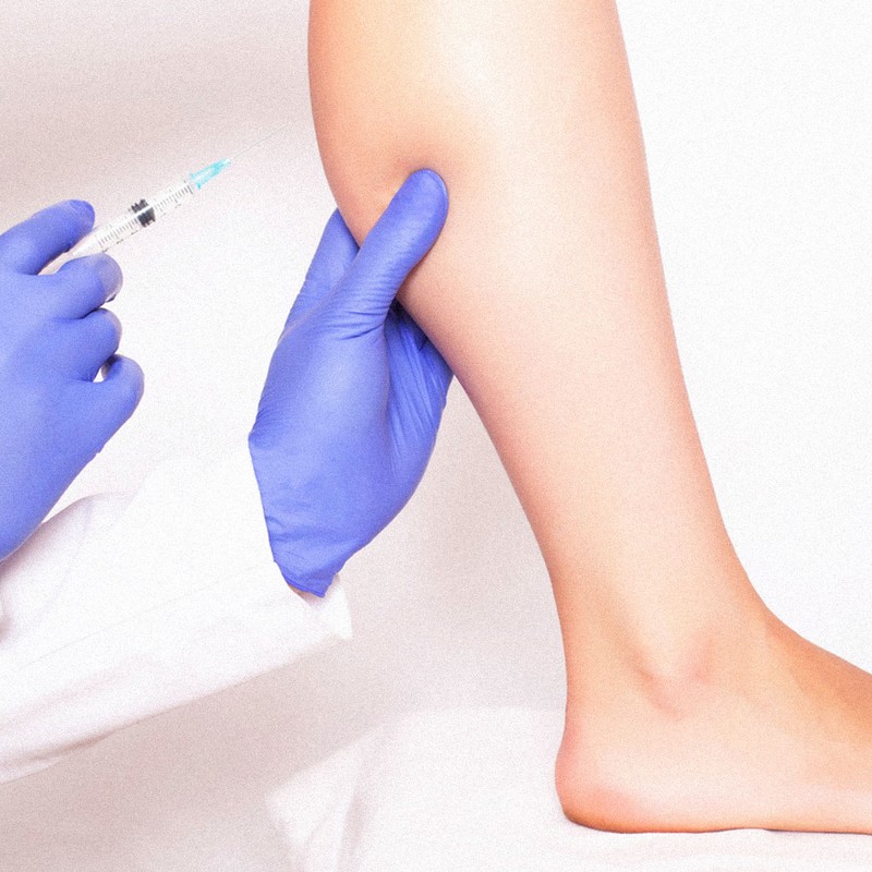 Calf Botox: What It Is & Why It’s So Popular