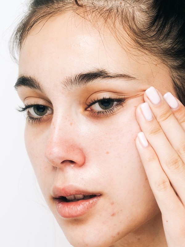 How To Conceal Spots Without Making Them Worse