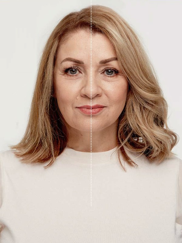 Two Products That Prevent Thinning Hair