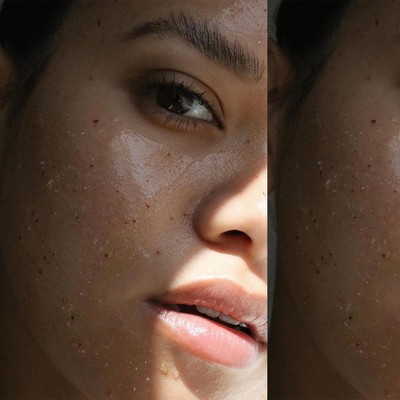 Expert Tips To Fix Post-Christmas Skin