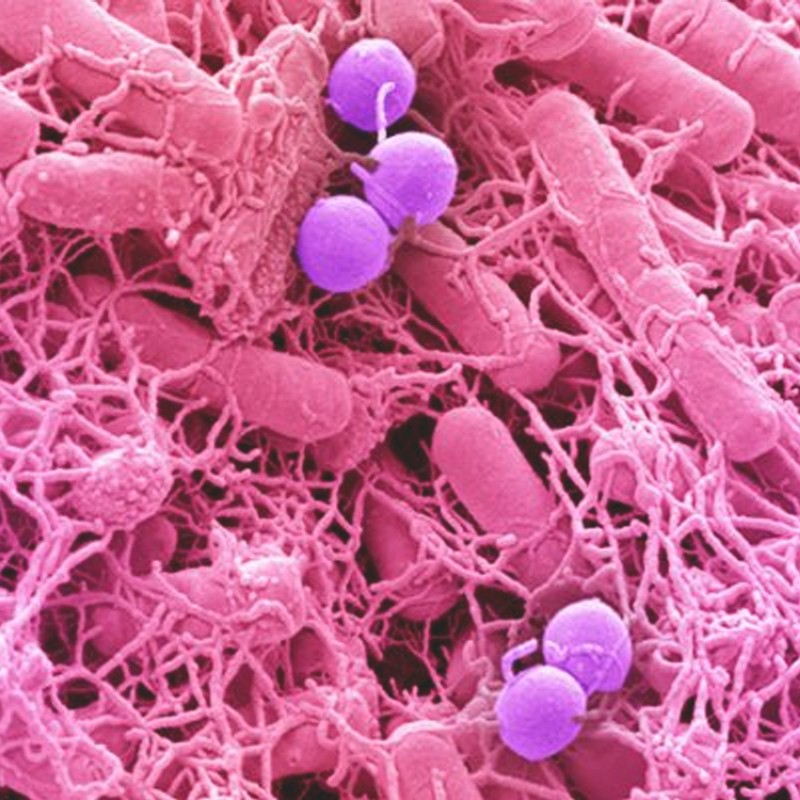 What You Need To Know About Bowel Cancer