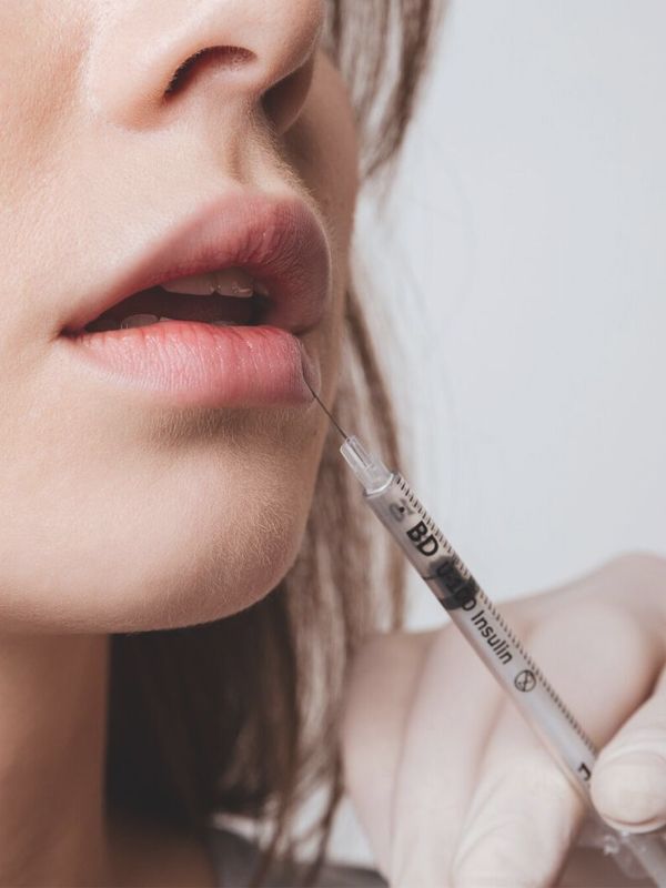 What It's Like To Have Lip Fillers Removed