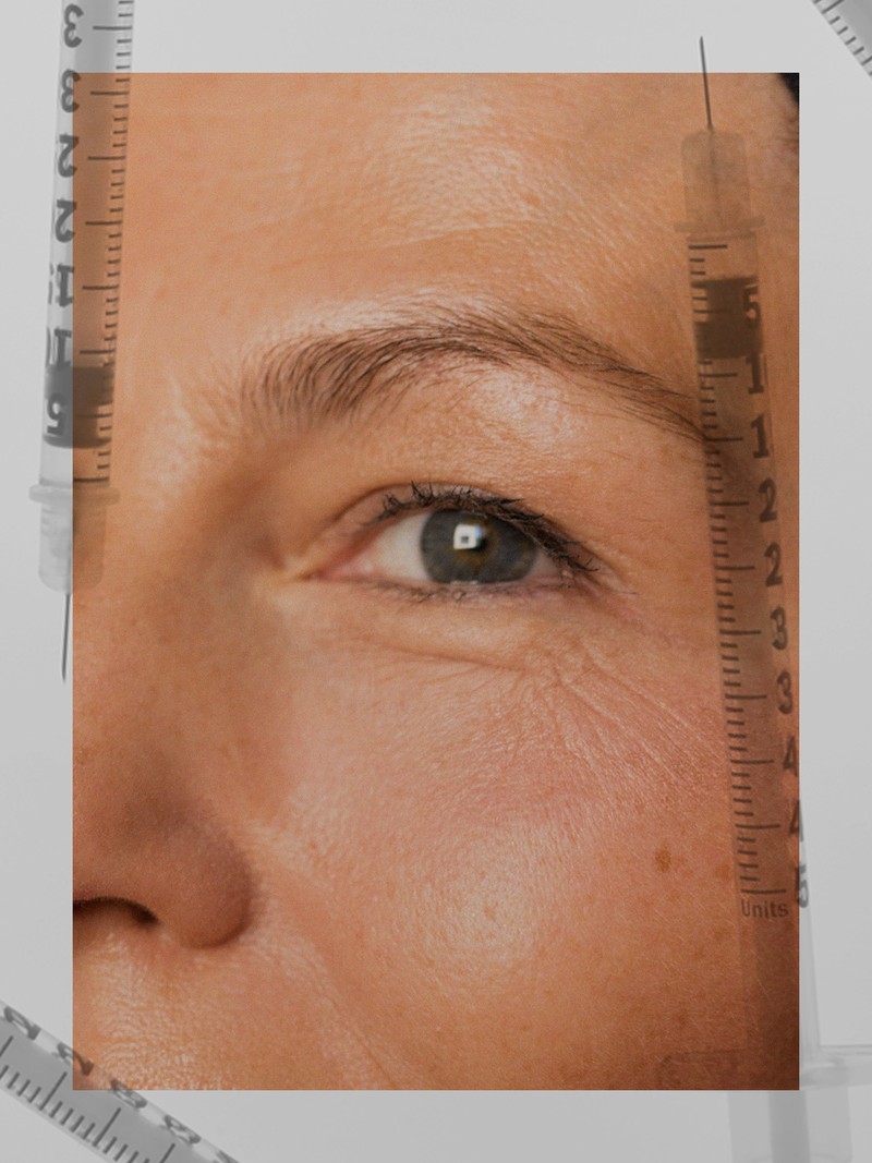 The New Skin Jabs That Will Change The Way You Think About Injectables