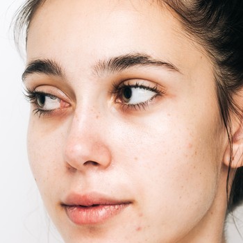 7 Spot Treatments That Actually Work