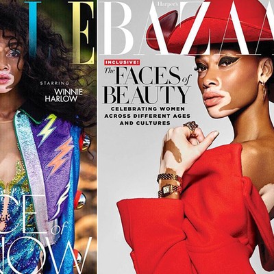 Monday Muse: Winnie Harlow