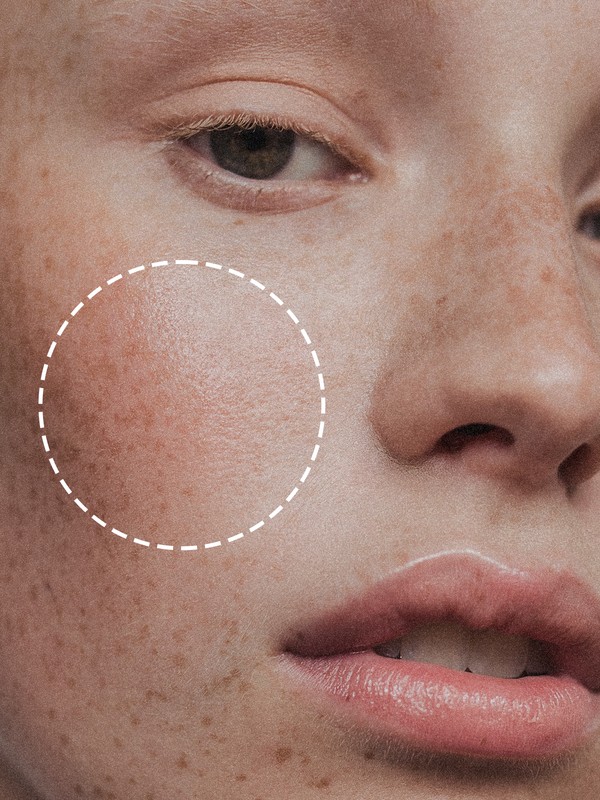 This Clever AI Tool Is A Game-Changer For Problem Skin
