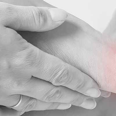 The Game-Changing Bunion Treatments To Try