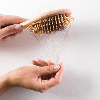 Hair Loss And Everything You Need To Know 