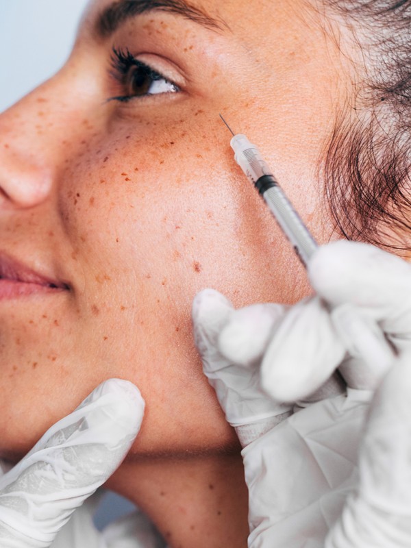 Considering Botox? Two Experts Share What To Consider First
