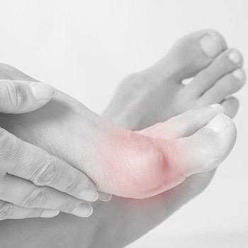 The Game-Changing Bunion Treatments To Try