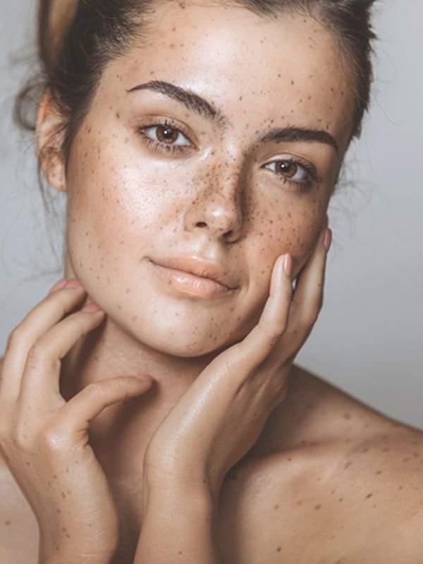 6 Reasons Why Your Skin’s Lost Its Glow