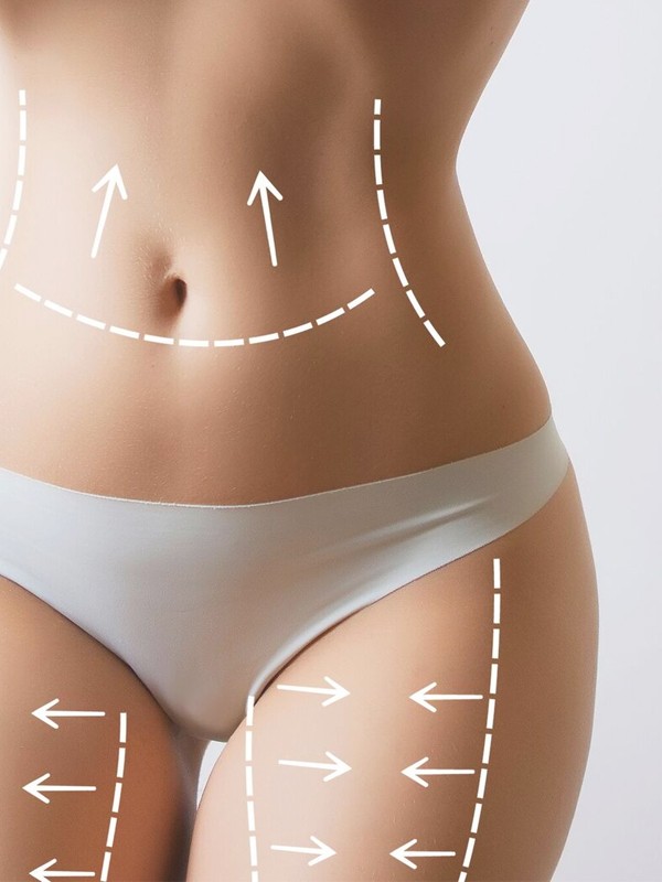 The Body Contouring Treatment That Actually Works