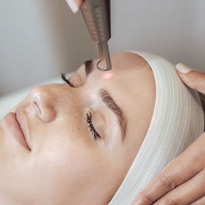 An Expert Guide To Laser Facial Treatments