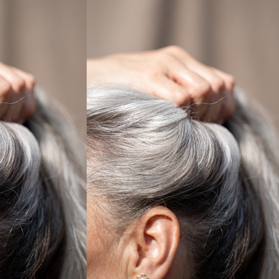 Your Top Hair Thinning Questions, Answered By A Trichologist