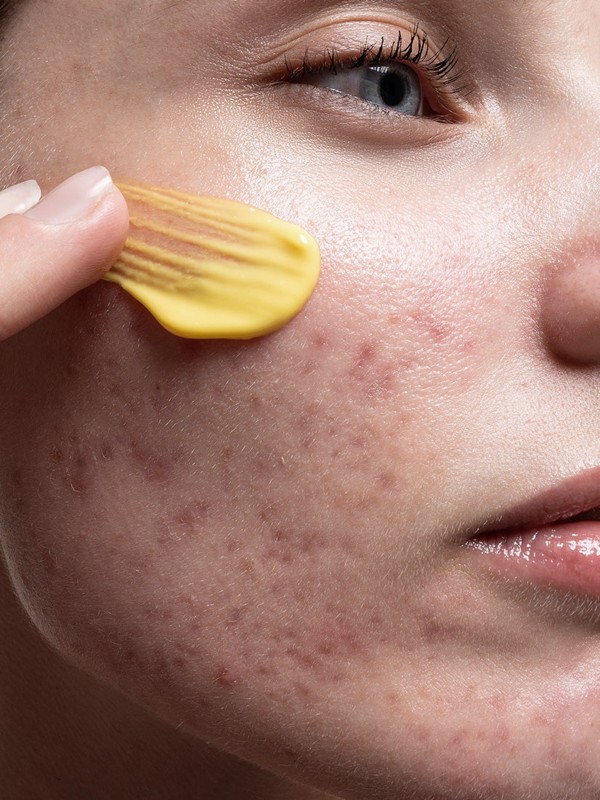 How To Treat Textured Skin