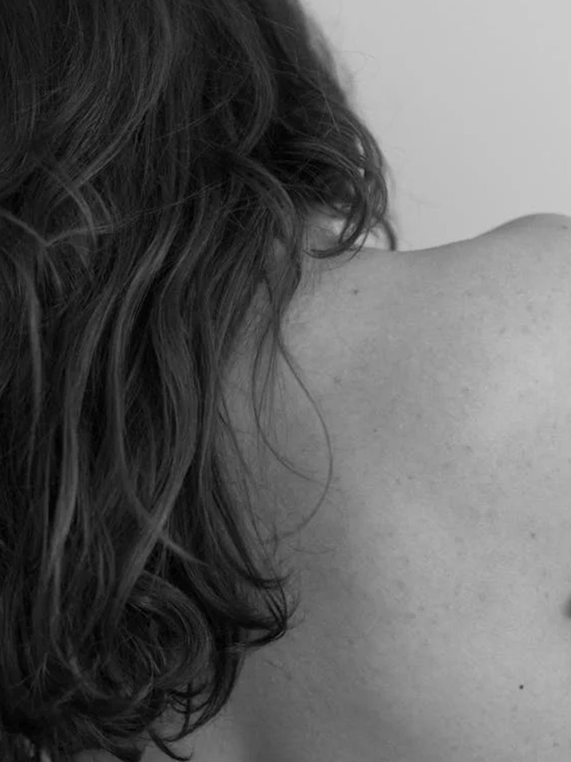 The Tips, Treatments & Best Products For Treating Keratosis Pilaris