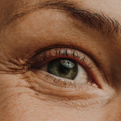 How To Treat & Smooth Crepey Eyelids