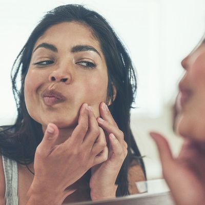 Adult Acne: Why It Happens & How To Treat It 