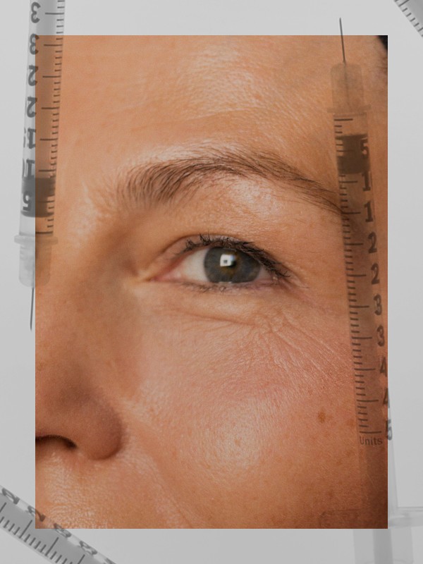 The New Skin Jabs That Will Change The Way You Think About Injectables