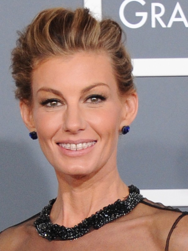 Everything You Need To Know About Adult Braces