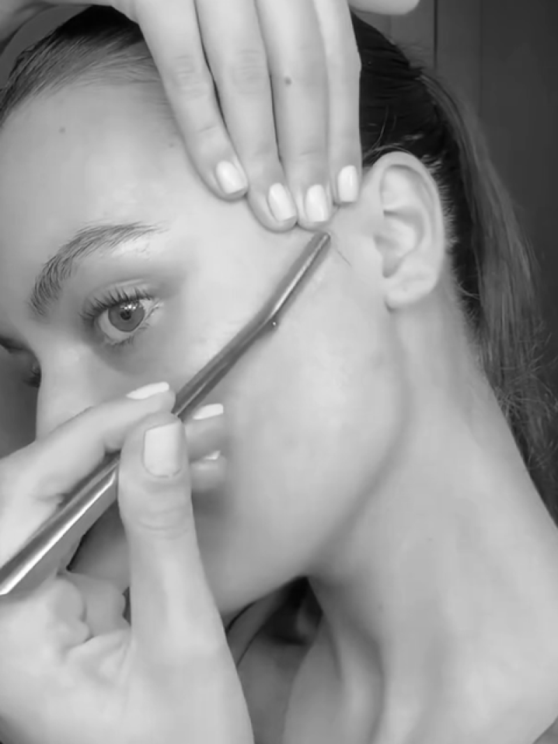 Everything You Need To Know About Dermaplaning