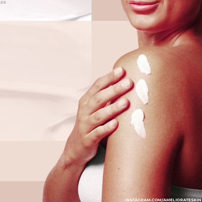 Keratosis Pilaris: What It Is & How To Lessen Its Appearance