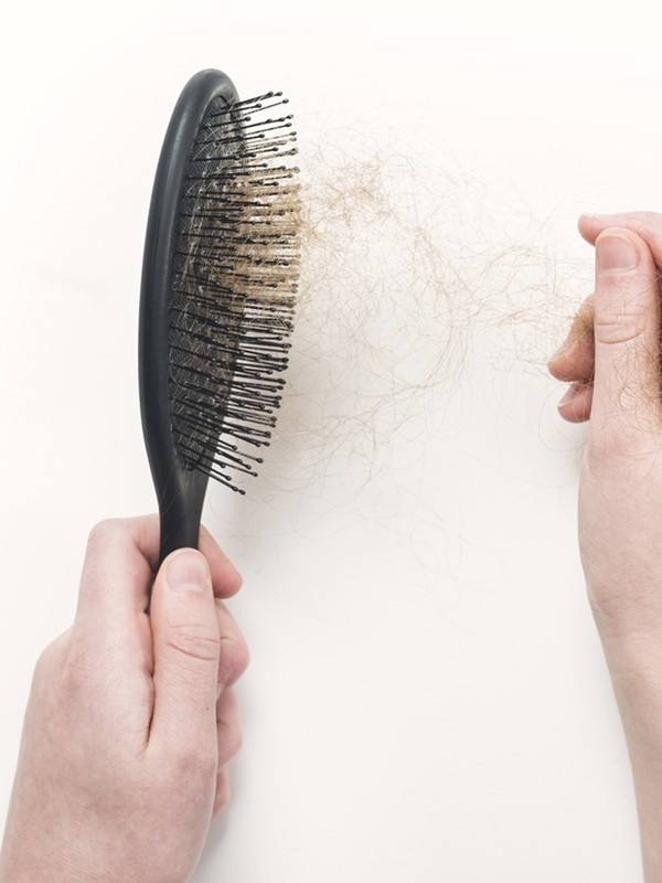 Worried Your Hair Is Getting Thinner? Read This.