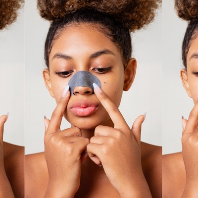 An Expert Guide To Dealing With Teen Acne
