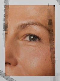 The New Skin Jabs That Will Change The Way You Think About Injectables