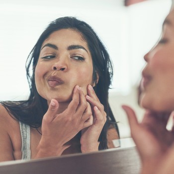 5 Ways To Treat Acne Scars