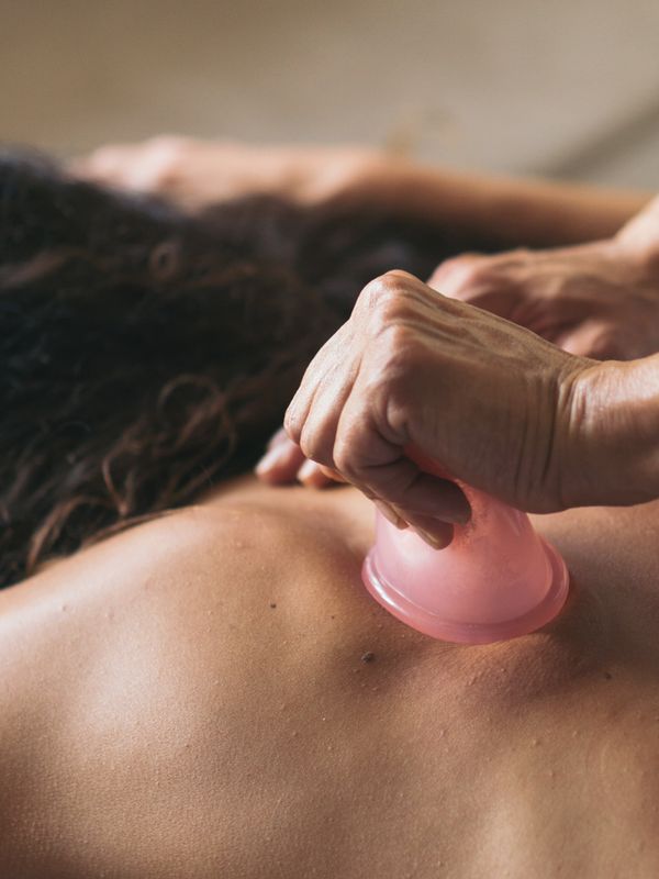 What You Need To Know About Cupping Therapy