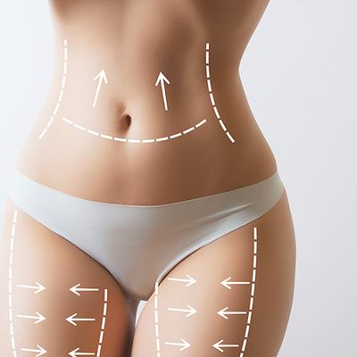 The Body Contouring Treatment That Actually Works