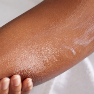 A Dermatologist’s Guide To Treating Keratosis Pilaris