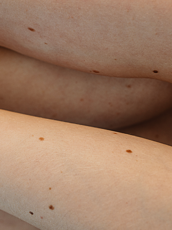 Everything You Need To Know About Mole Health