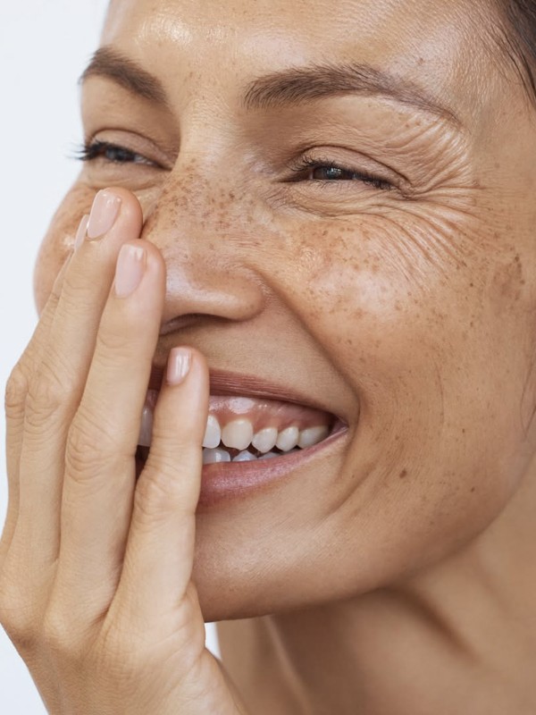 How To Tackle Hyperpigmentation & Dark Spots