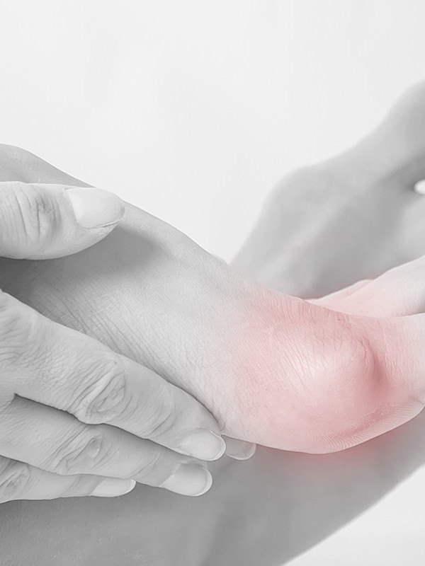 The Game-Changing Bunion Treatments To Try