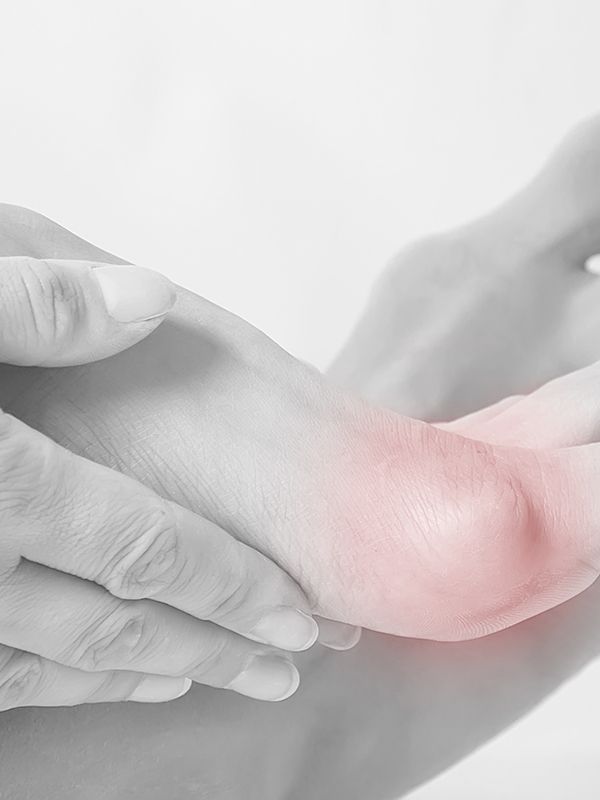 The Game-Changing Bunion Treatments To Try