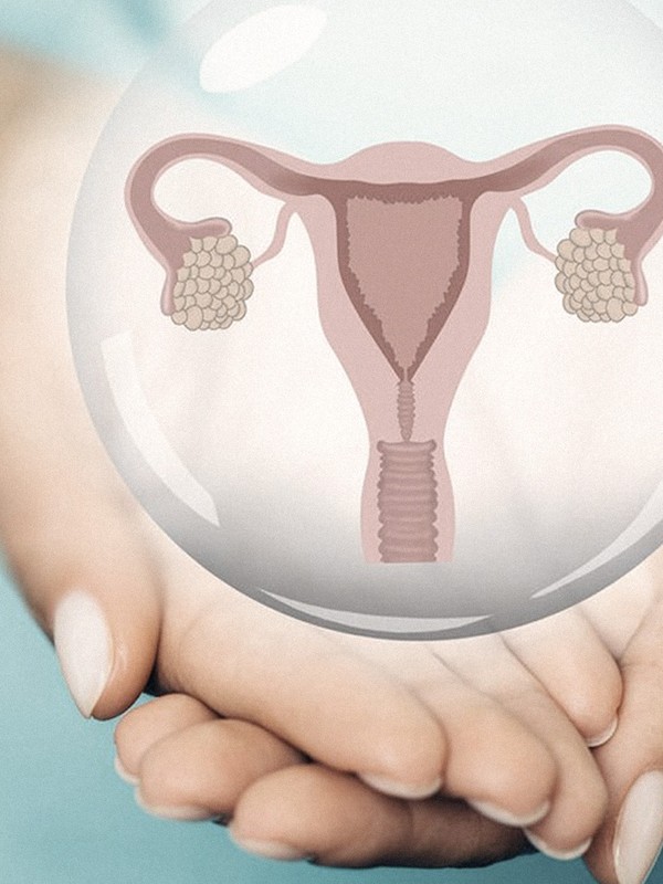 PCOS 101: From Diagnosis To Treatment 