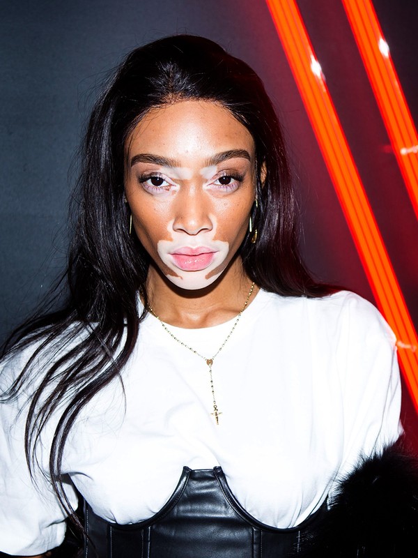 Monday Muse: Winnie Harlow