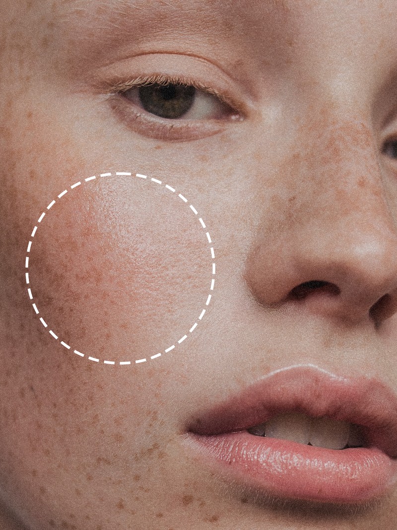This Clever AI Tool Is A Game-Changer For Problem Skin