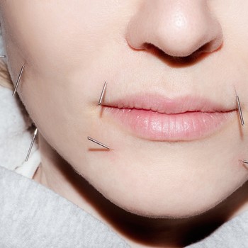 Cosmetic Facial Acupuncture: What It Is & Where To Try It 