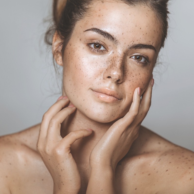 6 Reasons Why Your Skin’s Lost Its Glow