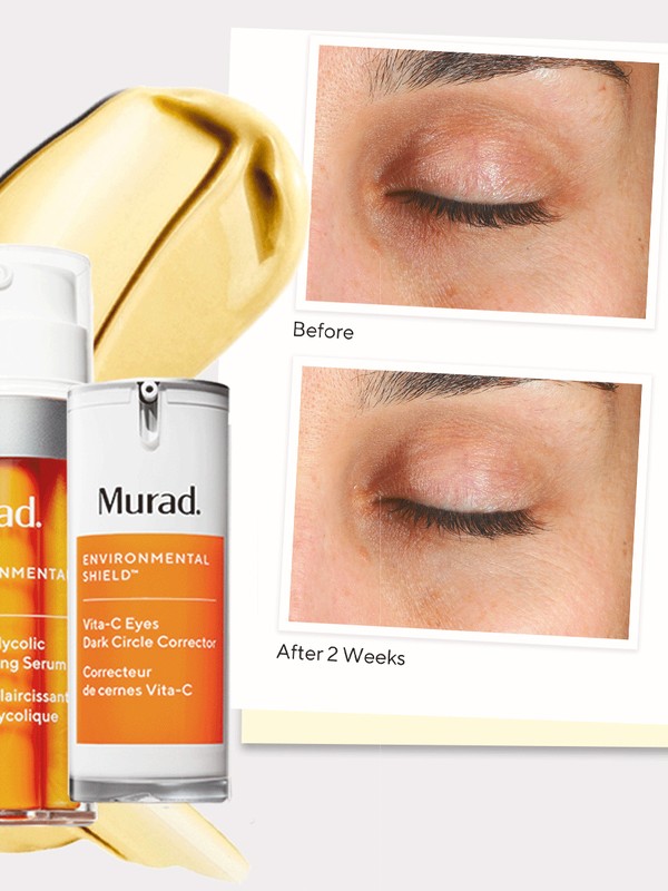 Why You Need Vitamin C In Your Skincare