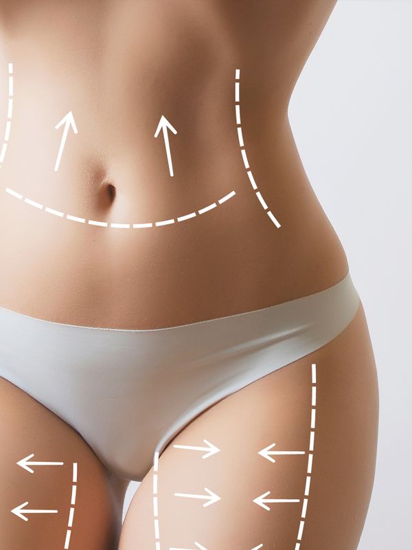 The Non-Surgical Fat Removal Treatment That Really Works