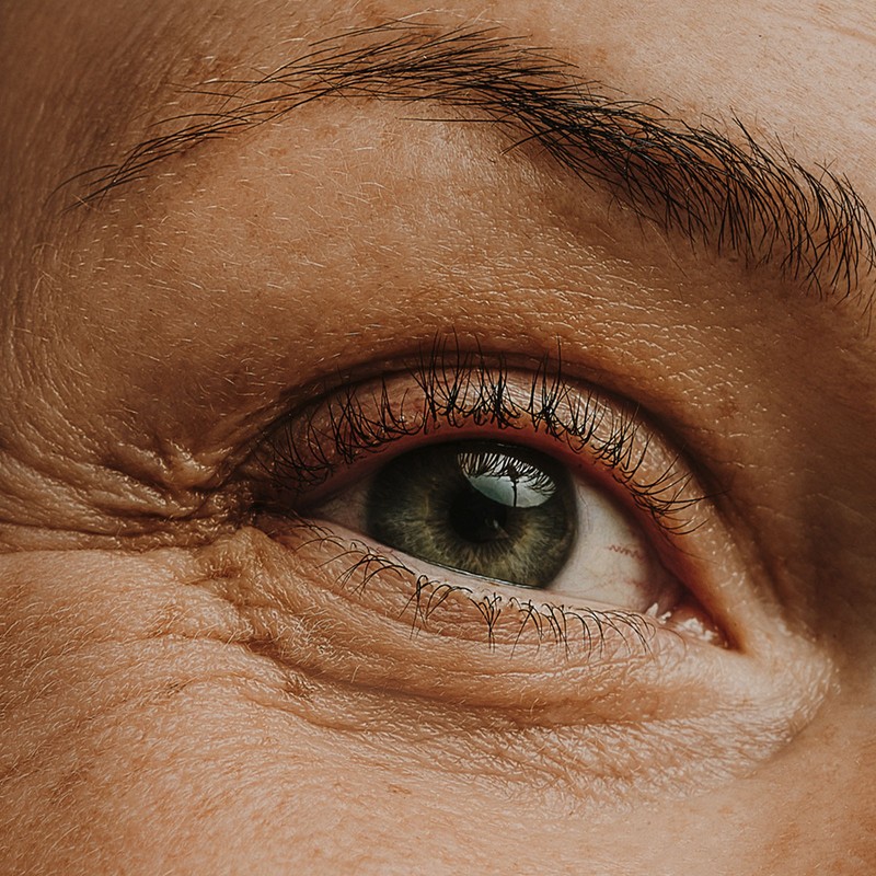 How To Treat & Smooth Crepey Eyelids