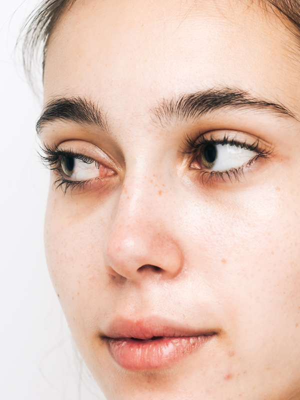 7 Spot Treatments That Actually Work