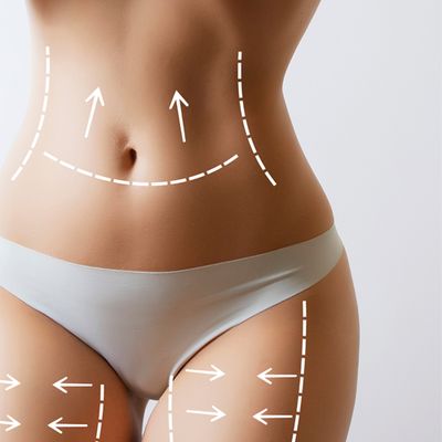 The Non-Surgical Fat Removal Treatment That Really Works