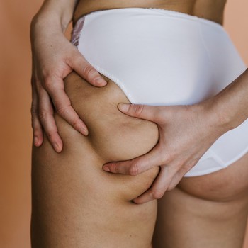 A Comprehensive & Honest Guide To Cellulite