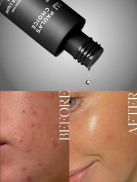 The Cult Exfoliator You Need In Your Skincare Routine